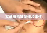 女童眼睛被塞纸片事件，深度剖析背后的安全隐患，呼吁关注儿童安全保护