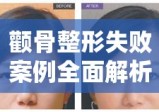 颧骨整形失败案例全面解析与深度剖析