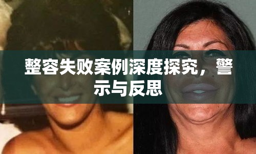 整容失败案例深度探究，警示与反思  第1张