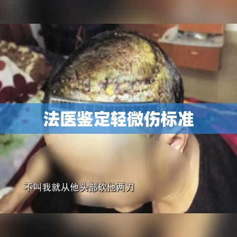 法医鉴定轻微伤标准详解，理解与应用指南  第1张