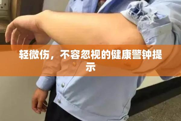 轻微伤，不容忽视的健康警钟提示  第1张