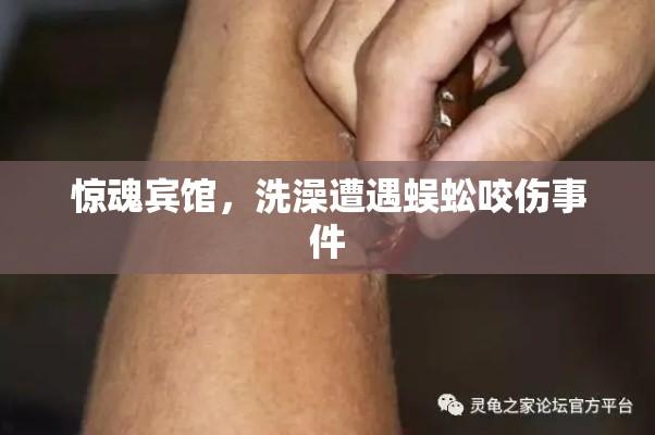 惊魂宾馆，洗澡遭遇蜈蚣咬伤事件  第1张