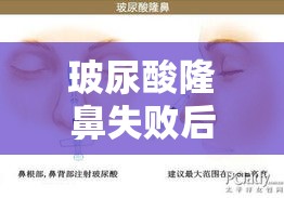 玻尿酸隆鼻失败后的经历、反思与信心重建之路  第1张