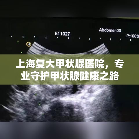 上海复大甲状腺医院，专业守护甲状腺健康之路  第1张