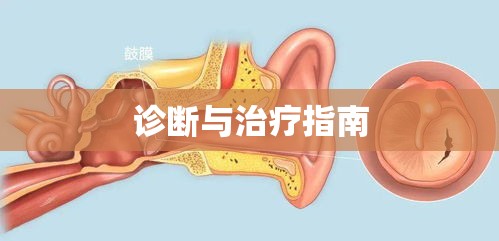 耳膜穿孔，全面理解、诊断与治疗指南  第1张